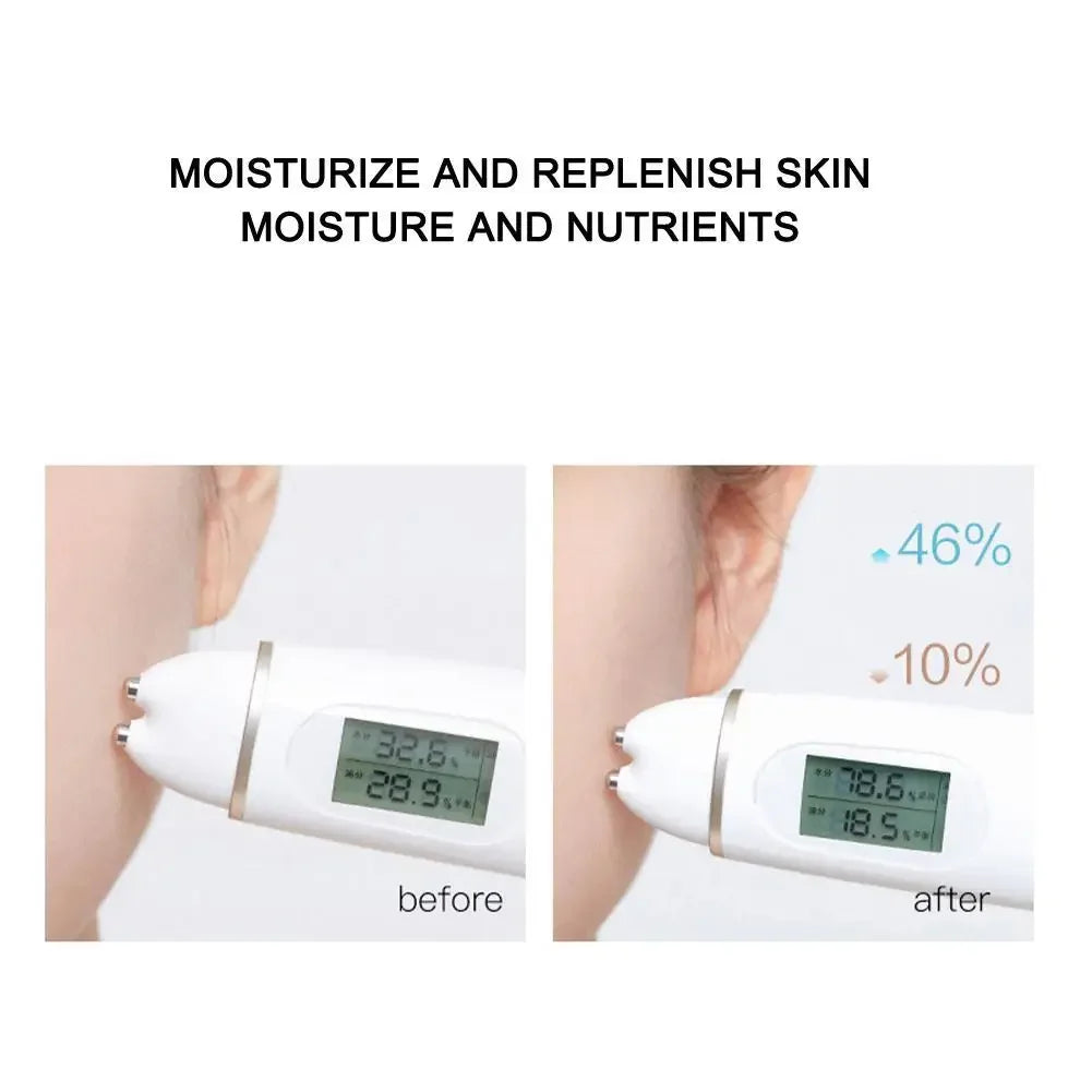 Protein Thread Lifting Set Face Filler Absorbable Collagen Protein Thread Firming Anti-Aging Smoothing Firming Moisturizing