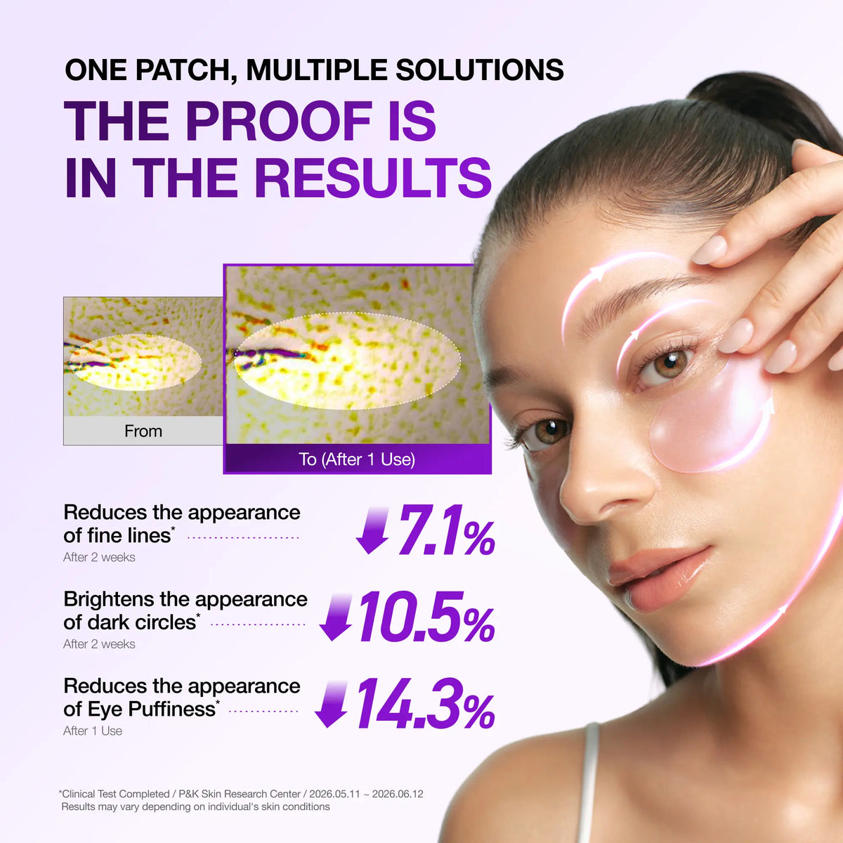 [Anua] Retinol Berry Revitalizing Eye Patch for Wrinkle and Dark Circles(60Ea), 8Hour Plumping Effect in 10 Minutes, Fuller Looking &amp; Lifted Skin, Hyal-Plumping Effect, Brightens Undereye by Antioxidant Berry Extracts, Relieves Puffiness with Caffeine