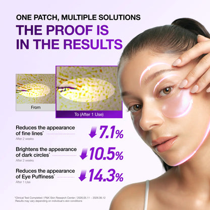 [Anua] Retinol Berry Revitalizing Eye Patch for Wrinkle and Dark Circles(60Ea), 8Hour Plumping Effect in 10 Minutes, Fuller Looking &amp; Lifted Skin, Hyal-Plumping Effect, Brightens Undereye by Antioxidant Berry Extracts, Relieves Puffiness with Caffeine