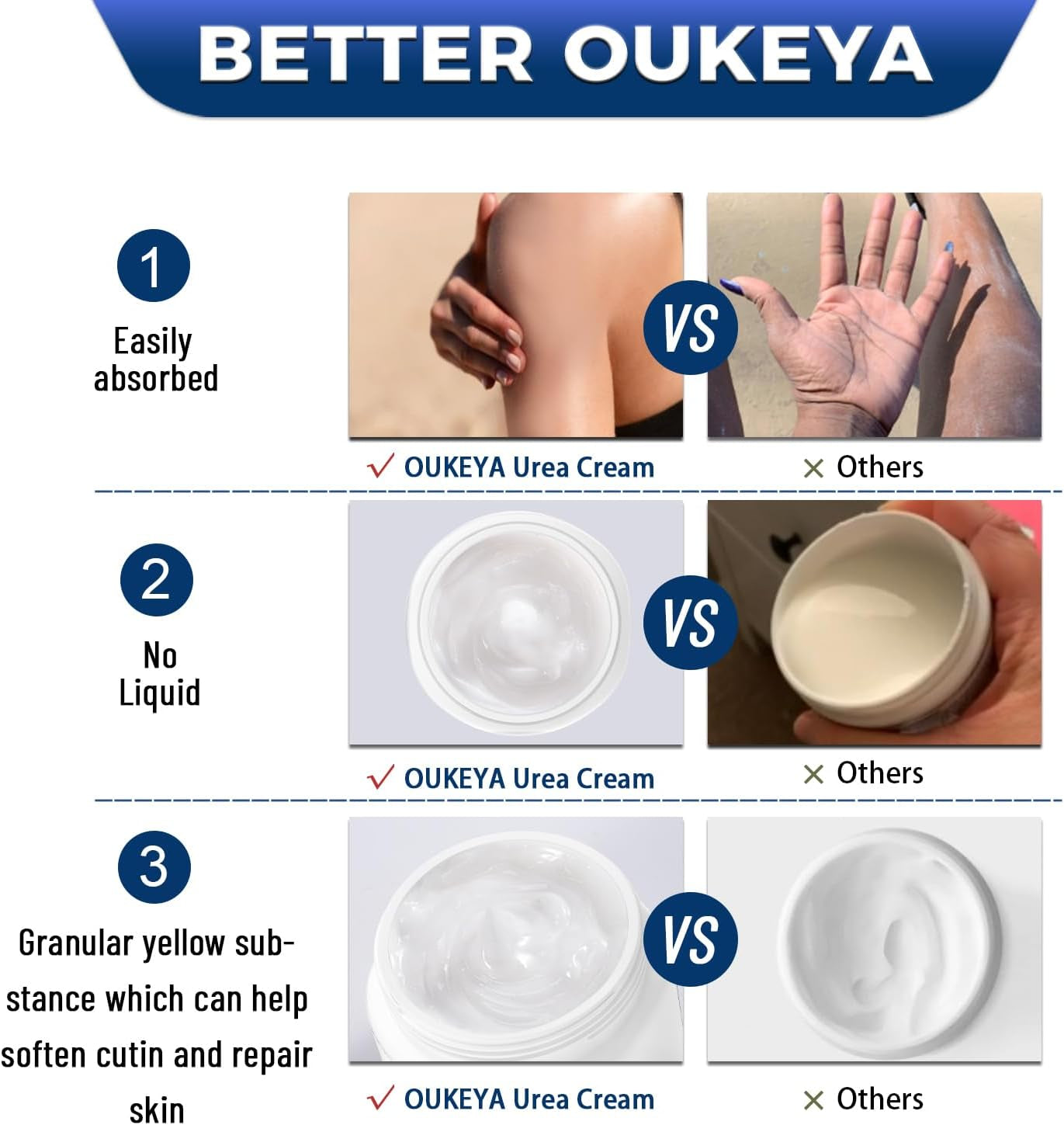 40% Urea Hand Foot Cream Intensive Moisturiser for Dry Cracked Skin | Intensive Moisturising Care for Dry Cracked Heels, Hands and Calloused Skin; 350G