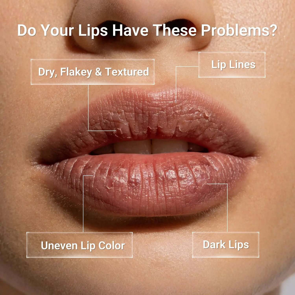 Dr.Leo Tinted Peptide Lip Serum – Brightens Dull-Looking Lips &amp; Smooths Lip Lines, Sheer-To-Buildable Glossy Color + Hydrating Lip Care, Pink Dew / Toast Nude, 15G 